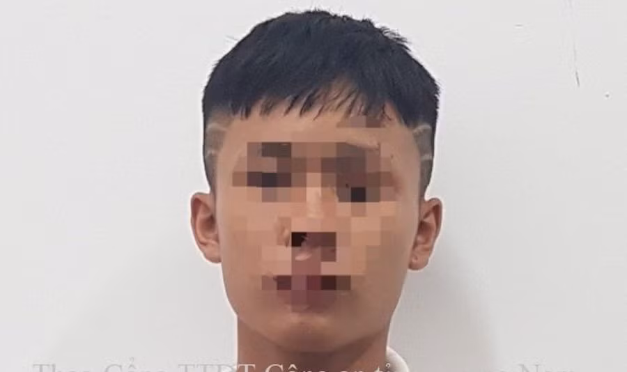  Cụ bà 83 tuổi bị cướp kẹp cổ giật dây chuyền vàng: N.D.H (16 tuổi, ngụ huyện Quế Sơn, Quảng Nam) đột nhập nhà cụ Phạm Thị Tư (83 tuổi, trú cùng địa phương) rồi dùng tay bóp cổ, giật sợi dây chuyền vàng cụ đang đeo rồi bỏ trốn. Ngày 3/9, Công an huyện Quế Sơn đã giữ người trong trường hợp khẩn cấp đối với H. 