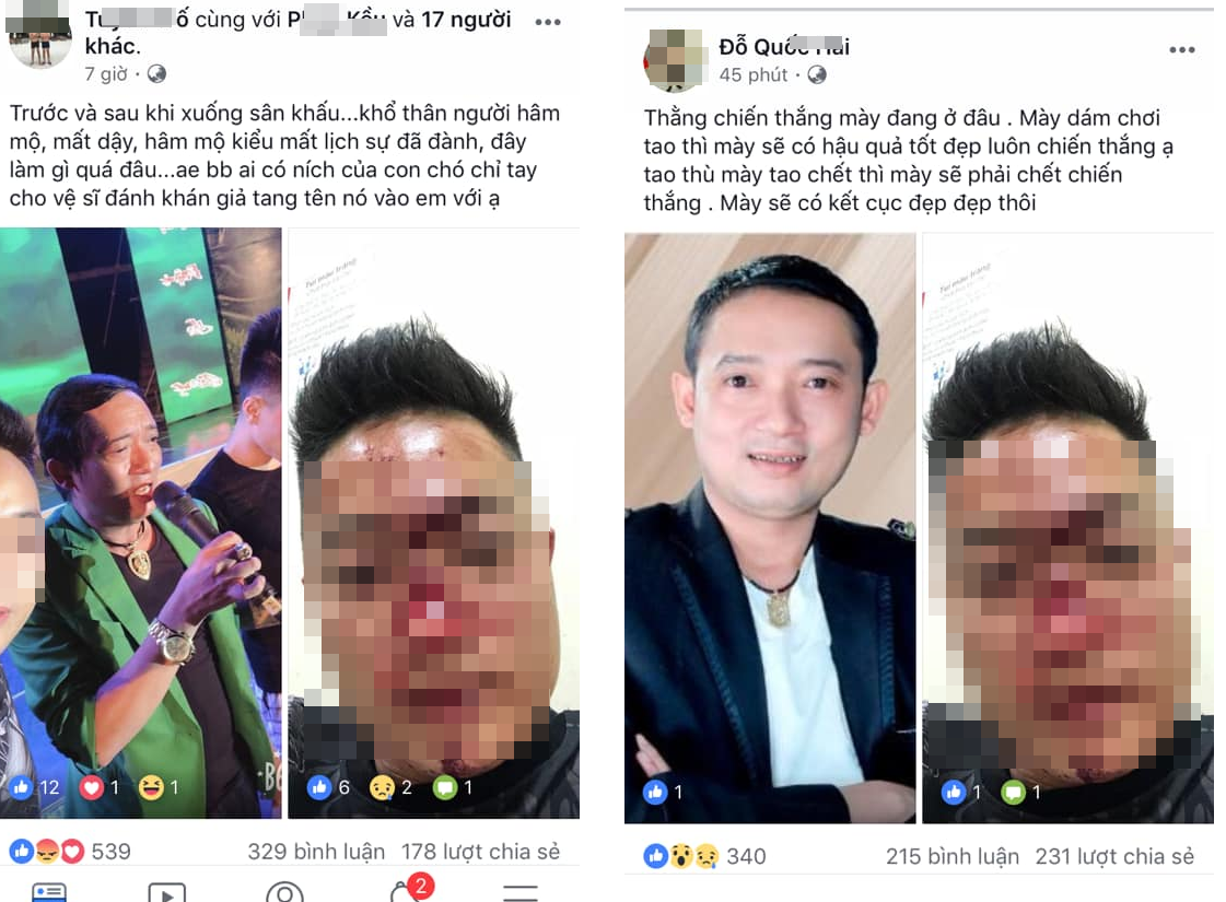 Nam khán giả sau đó đăng ảnh gương mặt be bét máu, đồng thời tố Chiến Thắng gọi vệ sĩ riêng đánh anh ta ra nông nỗi này.