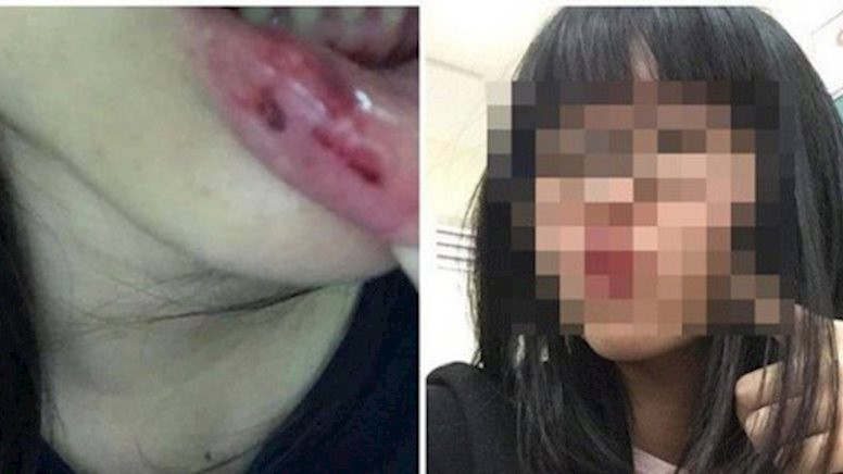 Trả lời với báo chí, MC Minh Tiệp khẳng định không có chuyện bạo hành như thông tin trên mạng và tin rằng gia đình bên vợ sẽ bảo vệ anh. Trong khi đó, làm việc với cơ quan chức năng, bố vợ MC Minh Tiệp xác nhận MC này có bạt tai em gái vợ lúc nóng giận nhưng không có chuyện bạo hành thường xuyên.