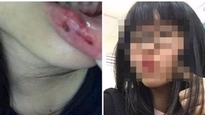 Trả lời với báo chí, MC Minh Tiệp khẳng định không có chuyện bạo hành như thông tin trên mạng và tin rằng gia đình bên vợ sẽ bảo vệ anh. Trong khi đó, làm việc với cơ quan chức năng, bố vợ MC Minh Tiệp xác nhận MC này có bạt tai em gái vợ lúc nóng giận nhưng không có chuyện bạo hành thường xuyên.