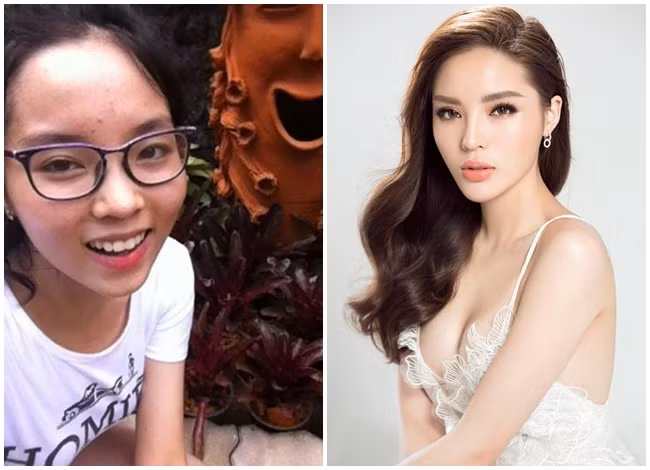 Hoa hậu Kỳ Duyên được nhận xét là "dậy thì thành công" nhất trong số các Hoa hậu Việt Nam. Thuở học sinh, cô nàng có làn da bánh mật cùng gương mặt lấm tấm mụn. Ngoài gương mặt khác lạ với chiếc cằm ngày càng nhọn, mới đây, người đẹp Nam Định còn vướng nghi vấn dao kéo vòng một vì quá sexy.