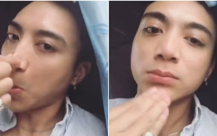 Trước nghi vấn dao kéo, giọng ca "Phía sau một cô gái" cho biết ngoại hình anh thay đổi là do tăng cân. Bản thân anh cũng không dám nghĩ tới phẫu thuật thẩm mỹ vì sợ... Nam ca sĩ còn quay hẳn clip tự véo mũi, bẹo cằm để chứng minh không "dao kéo".