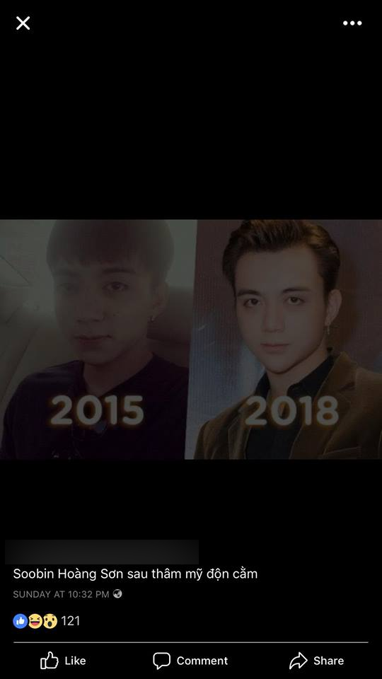Tuy nhiên ngay sau đó, một viện thẩm mỹ bất ngờ công khai trên fanpage hình ảnh hiện tại khác lạ của nam ca sĩ 26 tuổi so với 5 năm trước, kèm theo đó là dòng chú thích "Soobin Hoàng Sơn sau thẩm mỹ độn cằm".