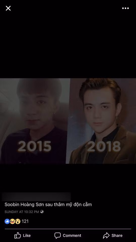 Tuy nhiên ngay sau đó, một viện thẩm mỹ bất ngờ công khai trên fanpage hình ảnh hiện tại khác lạ của nam ca sĩ 26 tuổi so với 5 năm trước, kèm theo đó là dòng chú thích "Soobin Hoàng Sơn sau thẩm mỹ độn cằm".