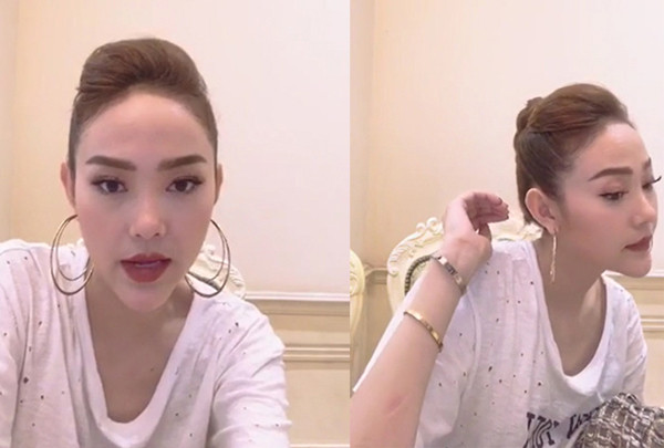 Khuôn mặt lạ lẫm cùng phần cằm nhọn hoắt cũng khiến Minh Hằng bị nghi ngờ đụng dao kéo.