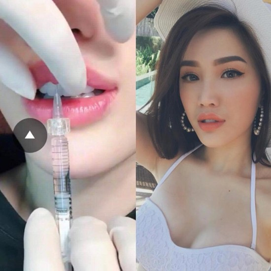 Người đẹp luôn cứng rắn đáp trả lại mọi bằng chứng liên quan đến việc phẫu thuật thẩm mỹ. (Ảnh FB, thẩm mỹ viện...)