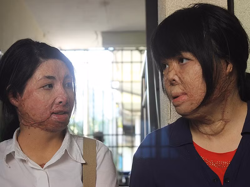 2 co gai bi chong do xang dot bien dang hinh hai