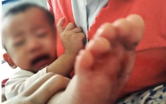 Be gai bi bong nuoc soi o truong hoc: Tam dinh chi truong mam non