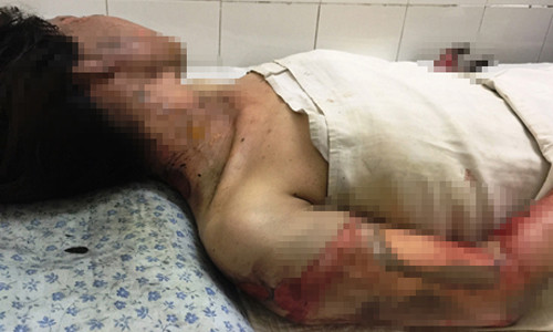 Tinh tiet khong ngo vu doi nam nu chay den trong phong-Hinh-2