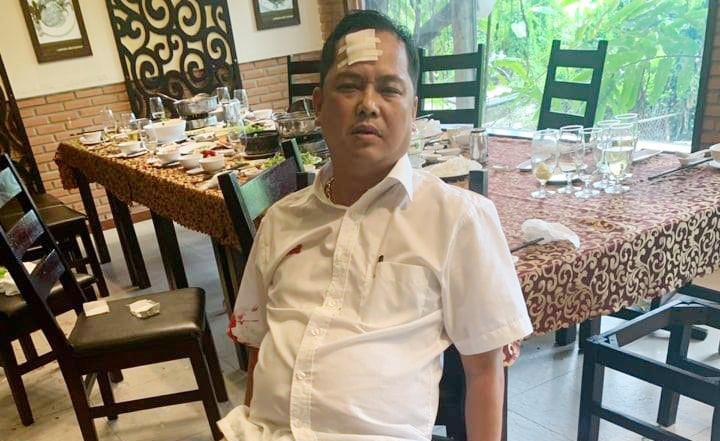 Vu giang ho vay xe cong an: Nguoi bi danh di giam dinh thuong tat