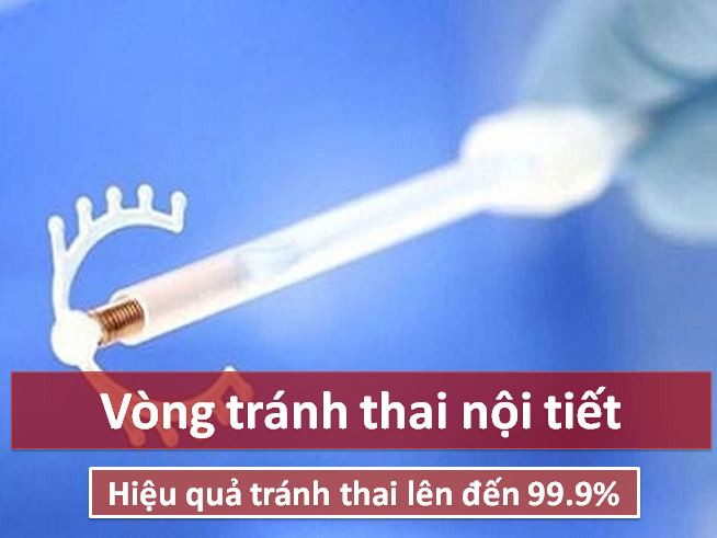 Ngoai bao cao su, phuong phap ngua thai nao hien dai va an toan?