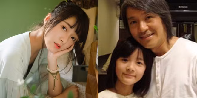 Con gai nuoi cua Chau Tinh Tri mat bien dang vi tham my-Hinh-2