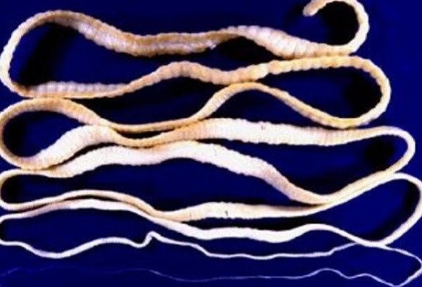 2 con san dai hon chuc met song nhieu nam trong nguoi dan ong