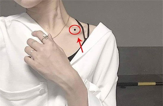 Vi tri not ruoi chua xui xeo, ca doi lan dan kho khan