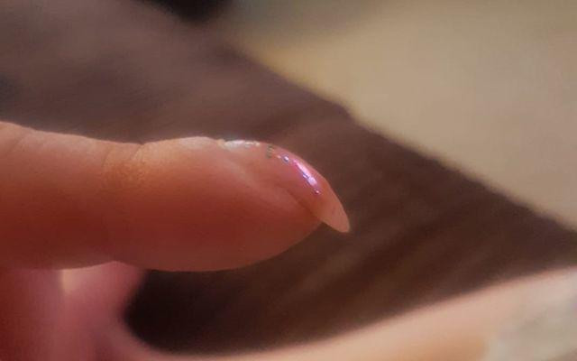 Ngon tay xuat hien dau hieu nay, canh giac vi co the la ung thu phoi