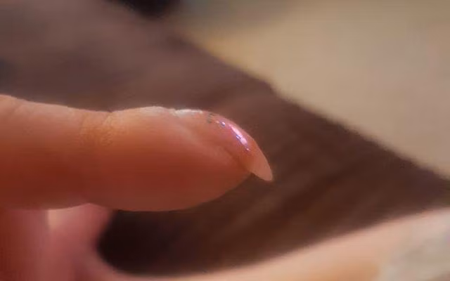 Ngon tay xuat hien dau hieu nay, canh giac vi co the la ung thu phoi