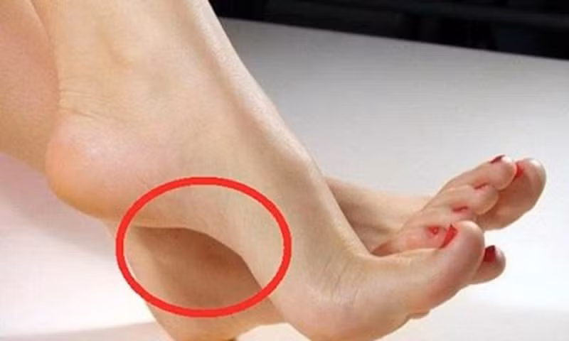 Tuong ban chan “cuc pham”, cuoc song chi toan di tren tham do