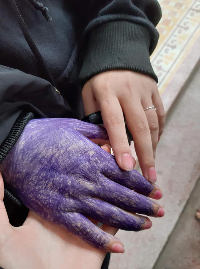 Bàn tay được "xăm trổ" kỹ lưỡng của cô bạn.