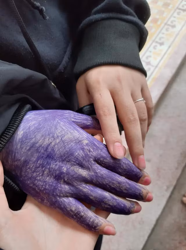 Bàn tay được "xăm trổ" kỹ lưỡng của cô bạn.