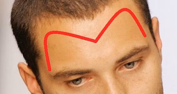 Người trán chữ M: Trong tử vi học và nhân tướng học thì người đàn ông có tướng trán chữ M chính là tướng may mắn, cuộc sống luôn dư dả sung túc hơn người.