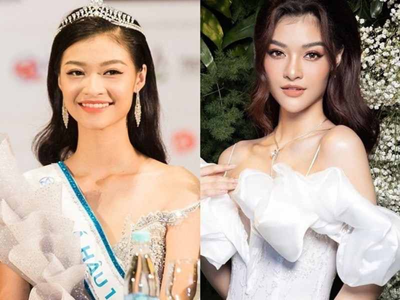 Sau khi trở thành Á hậu 1 Miss World Vietnam 2019, Kiều Loan chỉnh sửa gương mặt và vòng một. Ảnh: Sức Khoẻ Đời Sống.