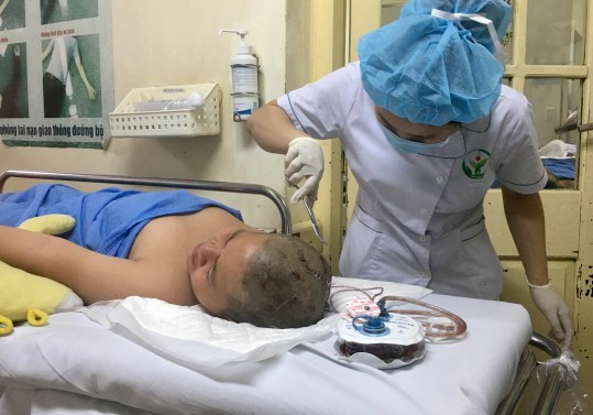 Suc khoe hoc sinh bi coc sat dam xuyen dau khi hoc the duc the nao?