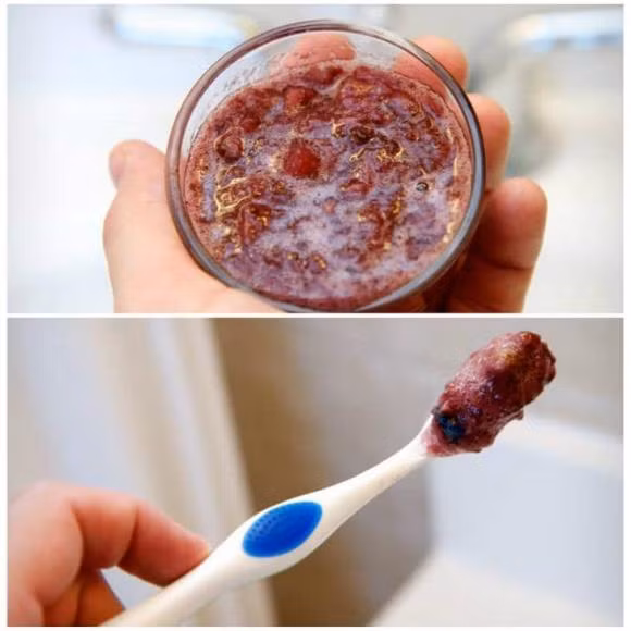 Tin được không, vỏ chuối giúp bạn có hàm răng trắng sáng như sao - Hình 4 Tin duoc khong, vo chuoi giup ban co ham rang trang sang nhu sao-Hinh-4