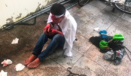 2 be gai bi cha duong phong hoa dot nha da tu vong