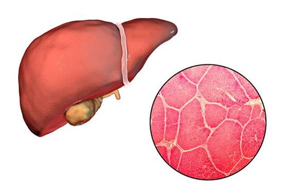 Neu tren mat xuat hien 3 dau hieu nay, ban chac chan co van de ve gan-Hinh-3