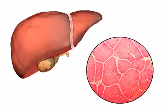Neu tren mat xuat hien 3 dau hieu nay, ban chac chan co van de ve gan-Hinh-3
