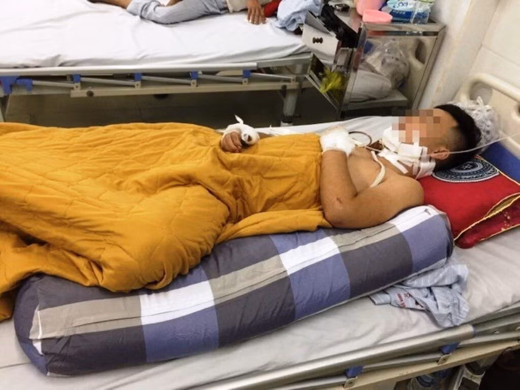 Mau thuan khi di an dem, nam thanh nien bi dam nguy kich