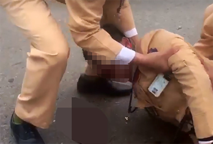 Quá trình chiếu chụp xác định trung úy Lê Tất Lâm bị chấn thương vùng mặt, tụ máu phần đầu.