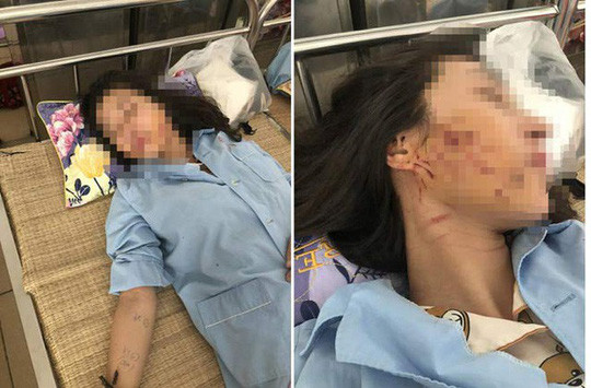 Chị L.T.G. bị thương ở mặt lúc điều trị tại bệnh viện.