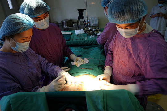 Các bác sĩ phẫu thuật bộ ngực khủng cho bệnh nhân - Ảnh: Bác sĩ cung cấp