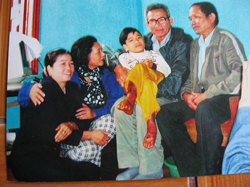 Chang trai 19 nam co doi chan nong nhu than gio ra sao?-Hinh-4