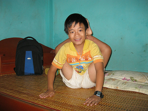 Chang trai 19 nam co doi chan nong nhu than gio ra sao?-Hinh-3