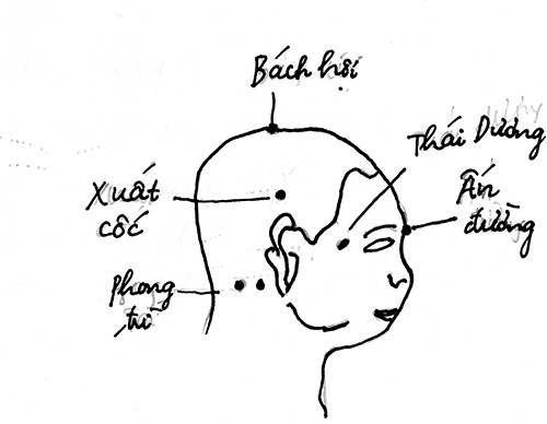 Chữa rối loạn tiền đình bằng y học cổ truyền Chua rói loạn tien dinh bang y hoc co truyen