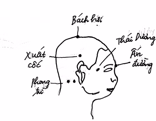 Chua rói loạn tien dinh bang y hoc co truyen