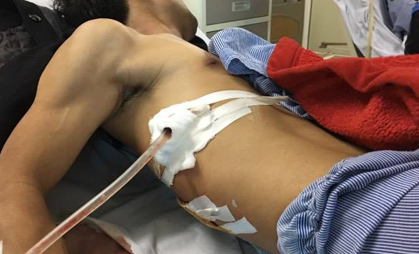 Nhung vu “oan gia” khi dua nguoi bi nan di cap cuu-Hinh-2