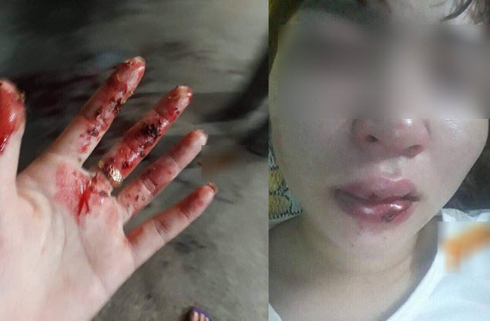 Nhung vu “oan gia” khi dua nguoi bi nan di cap cuu-Hinh-9