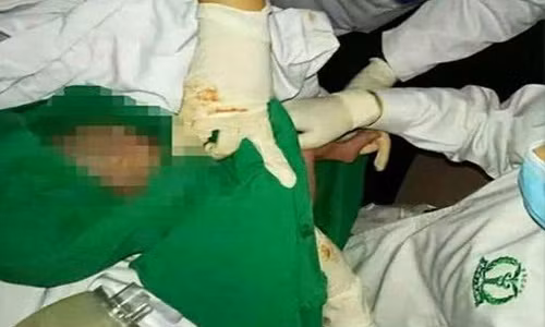 Bác sĩ dùng đèn smartphone đỡ đẻ giữa đêm Bac si dung den smartphone do de giua dem