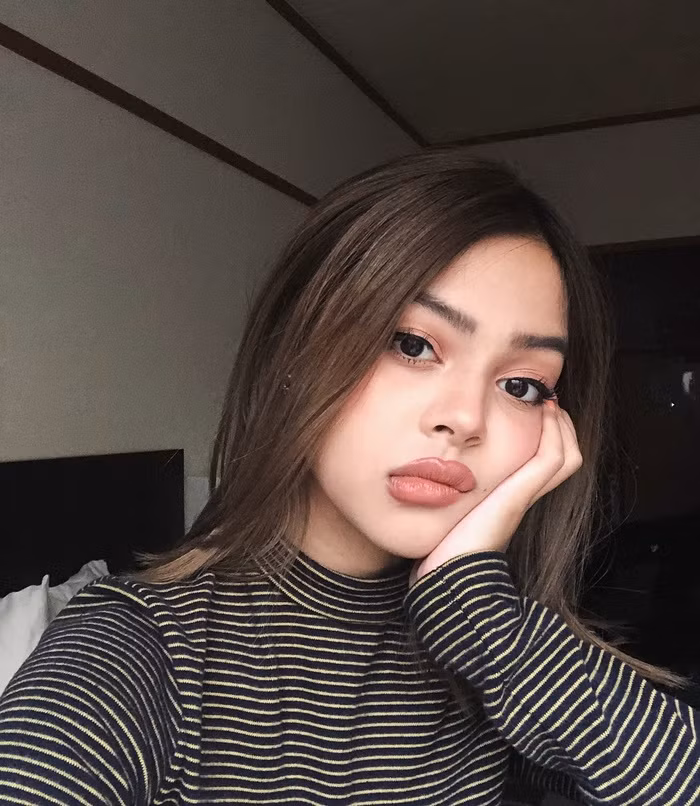Hot girl Lily Maymac de lo vet ran da xau xi, dan mang chi cach xoa mo-Hinh-2