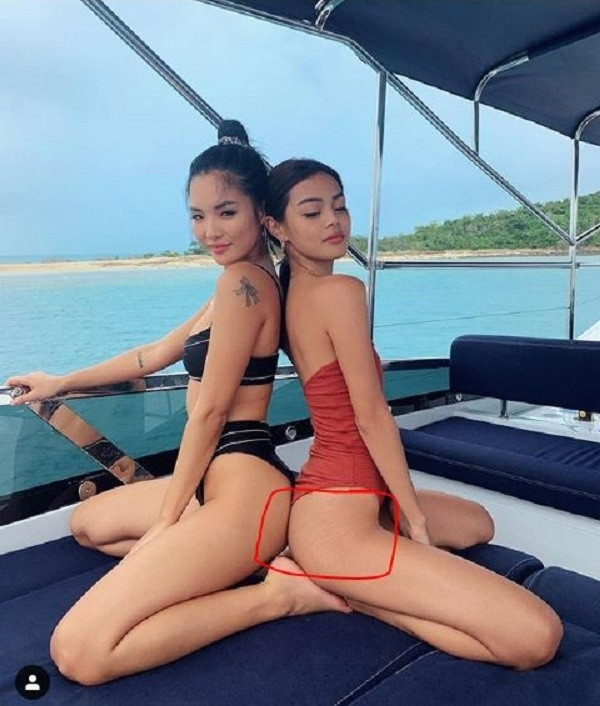 Hot girl Lily Maymac de lo vet ran da xau xi, dan mang chi cach xoa mo