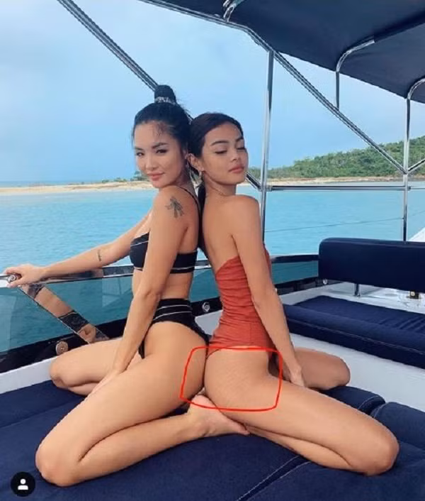 Hot girl Lily Maymac de lo vet ran da xau xi, dan mang chi cach xoa mo