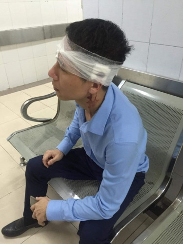 6.Tài xế taxi hành hung lái xe bán tải vì va chạm khi xi nhan: Tối 16/2, anh Bùi Thế Phúc lái xe bán tải Chevrolet Van BKS 29D-12494 di chuyển hướng Hàng Trống - Lý Thái Tổ (Hoàn Kiếm) thì va chạm nhẹ với chiếc taxi Vic mang BKS 30E-65025. Thấy va chạm gần như không gây thiệt hại, nên anh Phúc tiếp tục lái xe đi. Tuy nhiên, tài xế taxi Vic đã vượt lên để chặn đầu yêu cầu anh Phúc phải xin lỗi. Không được xin lỗi, tài xế taxi Vic lấy thanh tuýp (móc lốp xe ô tô) đuổi theo, đập vào đầu anh Phúc rồi bỏ đi. Anh Phúc được đưa vào bệnh viện Việt Đức để điều trị vết thương vì bị mất máu nhiều khiến anh choáng.