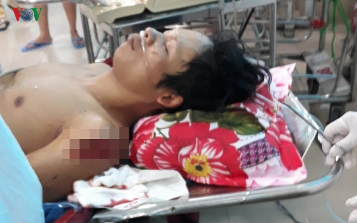 4.Đối tượng chém con nợ ở Tiền Giang ra đầu thú: Chiều 17/2, Nguyễn Phước Thuận (SN 1978, ngụ ấp 3B, xã Đạo Thạnh, thành phố Mỹ Tho) cùng 2 đối tượng khác đến đòi nợ tại nhà anh Đỗ Minh Thái (SN 1986), ngụ cùng địa phương. Sau đó, giữa Thuận và Thái xảy ra mâu thuẫn dẫn đến đánh nhau. Thuận dùng dao tự chế chém nhiều nhát vào người Thái làm nạn nhân ngã quỵ.