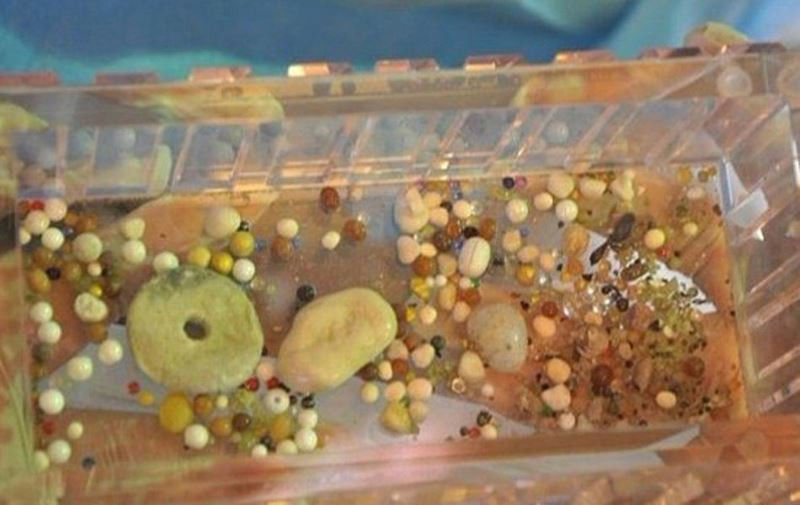 Cũng có quan điểm cho rằng xá lợi được hình thành nhờ thói quen ăn chay, ngồi thiền của nhà sư.