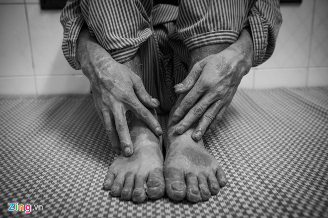 Can benh khien 2 trieu nguoi Viet khon kho den muc muon tu tu