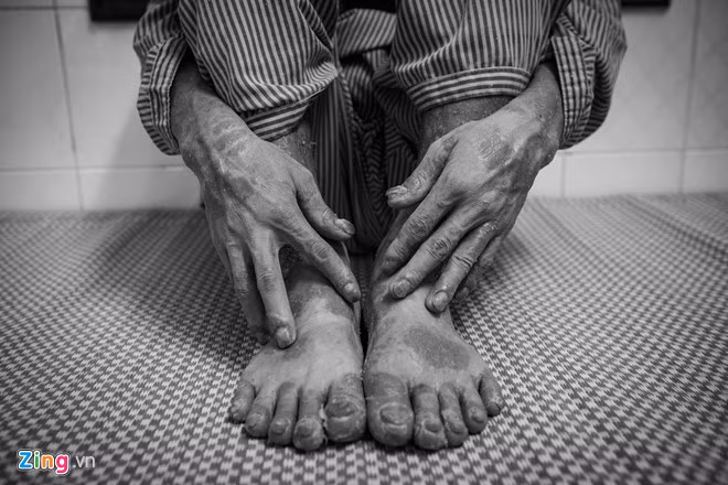 Can benh khien 2 trieu nguoi Viet khon kho den muc muon tu tu