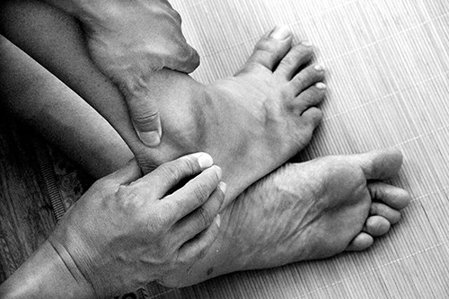 Cung khop sau bong gan co chan, phai lam sao?